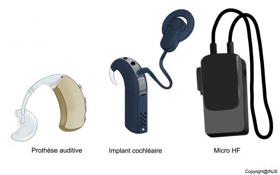 Les appareils auditifs